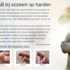 Review Gloves In A Bottle Eczeem